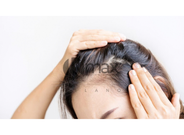 Weibliche Alopezie: Ursachen und Behandlungen erklärt vom Trichologen